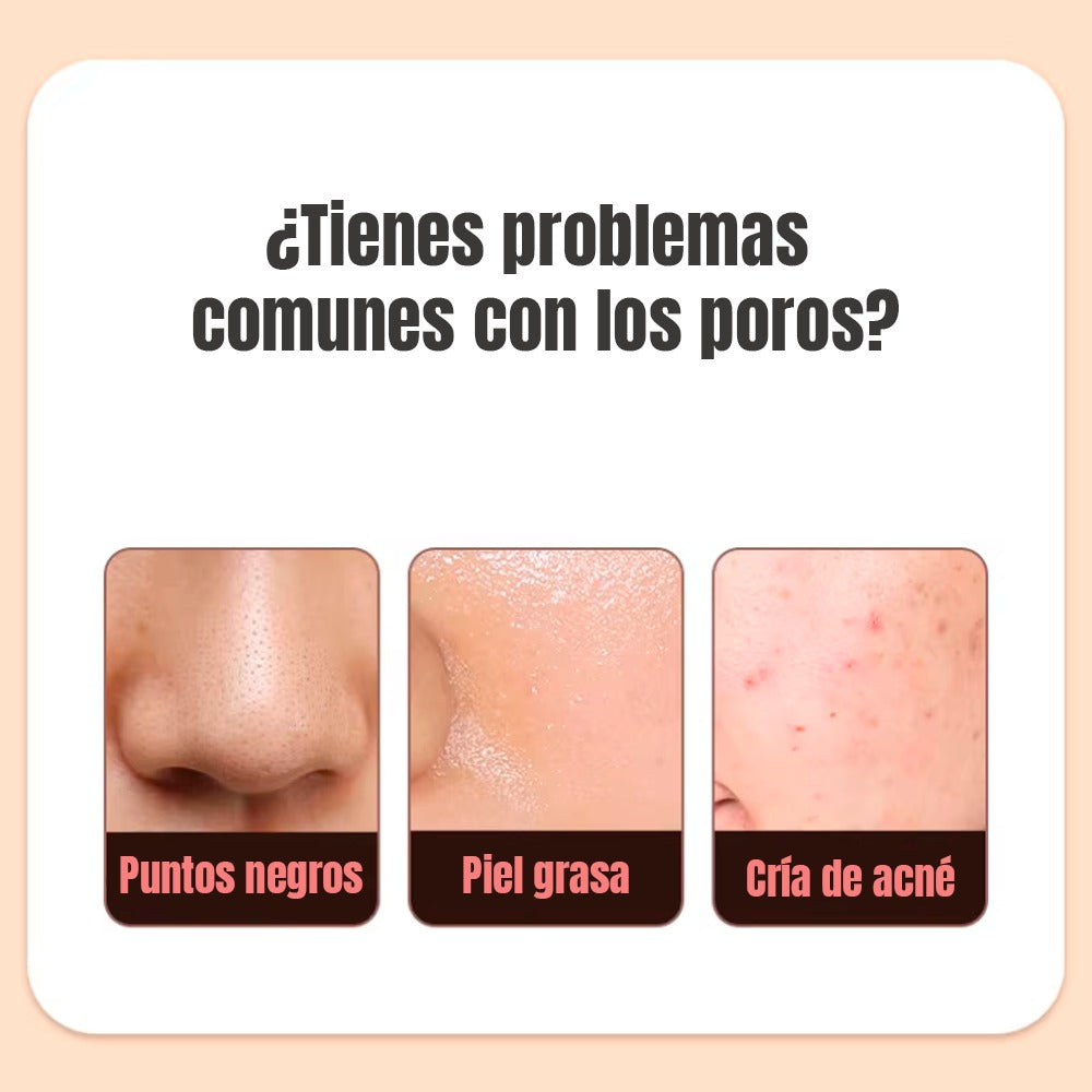 LIMPIADOR FACIAL ULTRASÓNICO