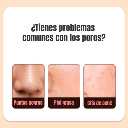 LIMPIADOR FACIAL ULTRASÓNICO